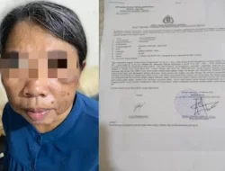 Oknum Dokter PNS dipolisikan ,diduga Aniyaya ART